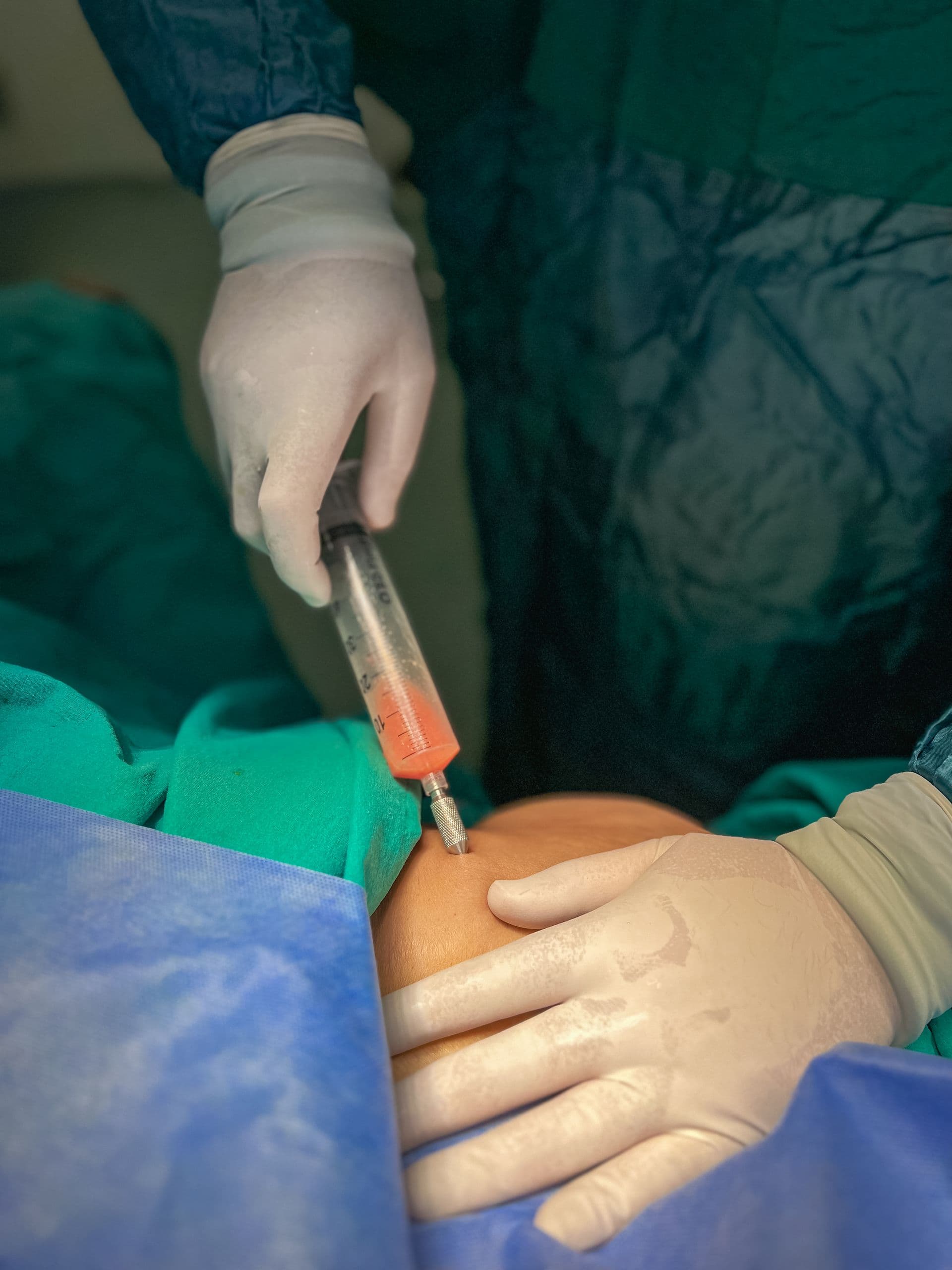 Cirurgia plástica é só vaidade? O que muda além do espelho