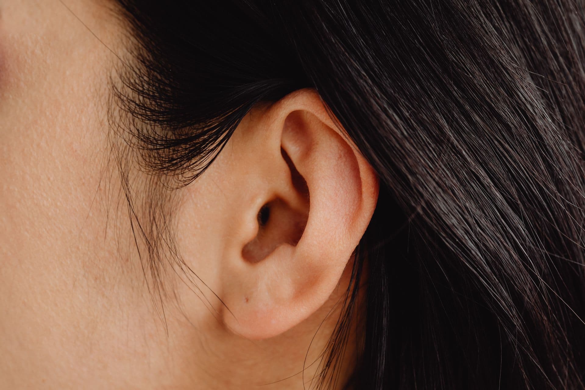 Orelhas em abano: quando corrigir vai além da estética